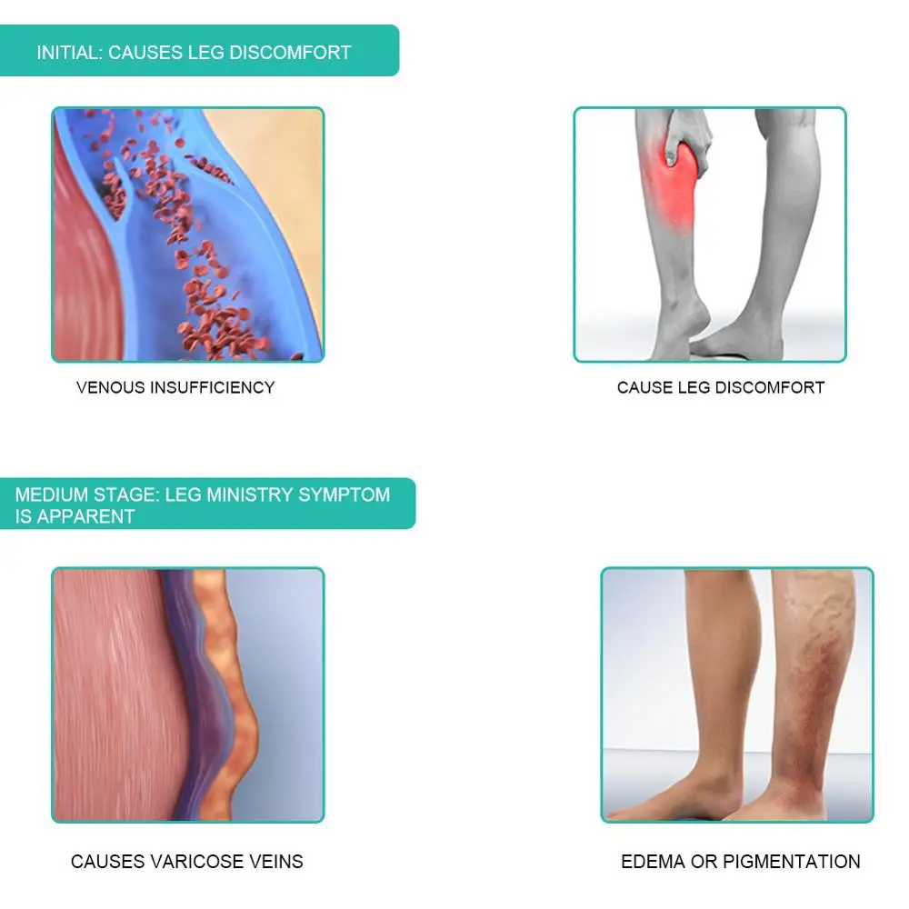 1Pair Medical Compression Sock - Compression Sock Medical 评论和价格