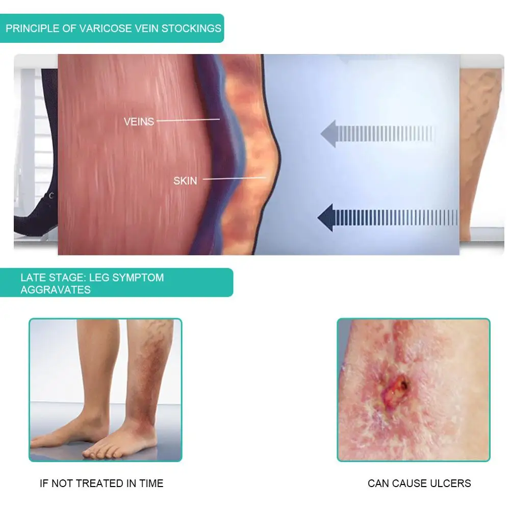 1Pair Medical Compression Sock - Compression Sock Medical 评论和价格